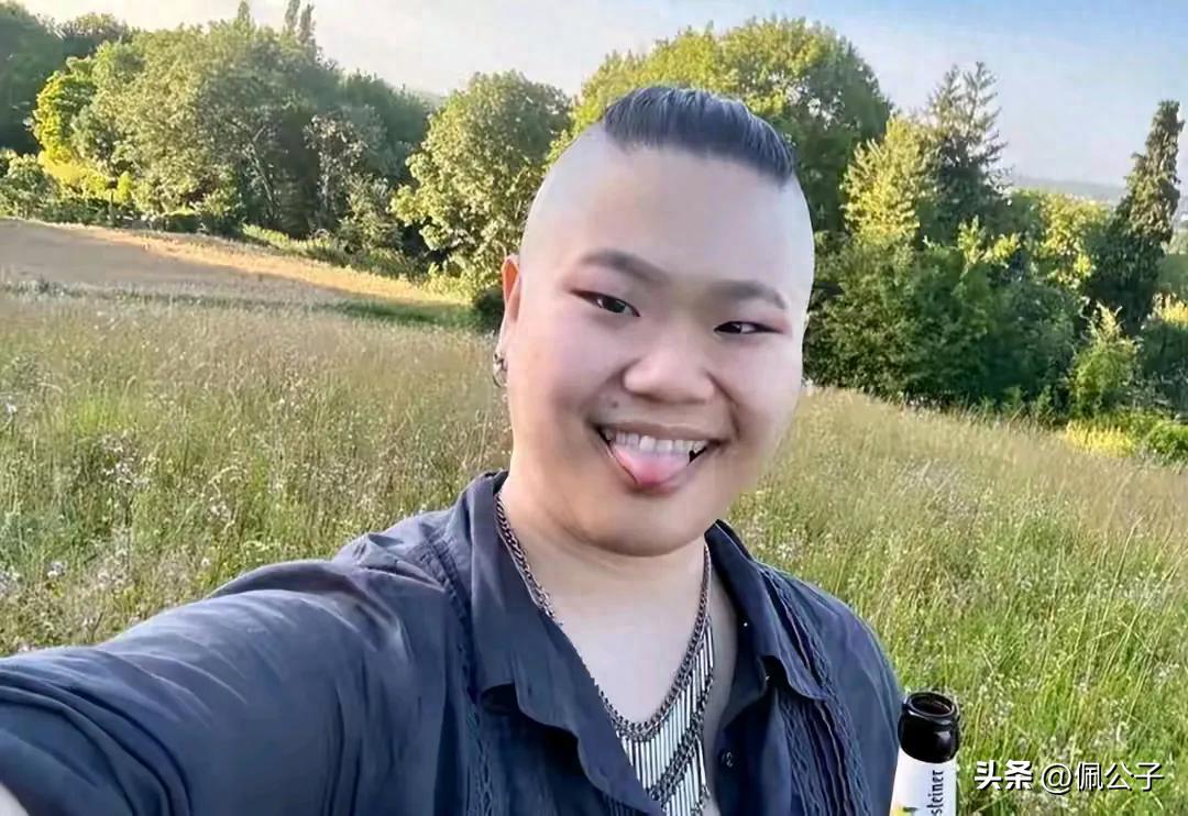 什么是性别认同障碍？_性别认同障碍症根治